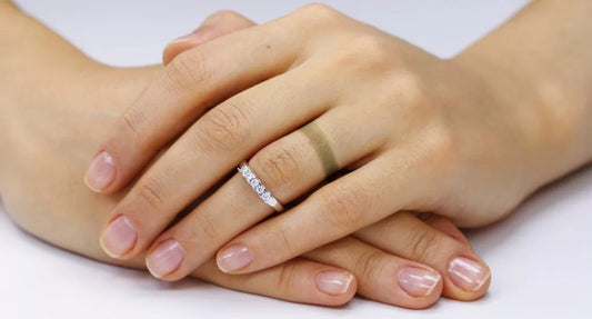 Finger tarnished by ring.